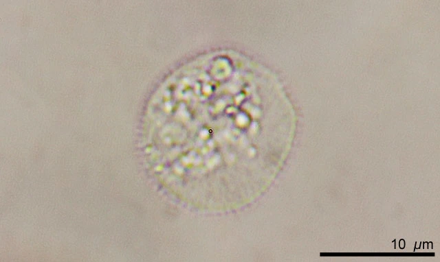 Cochliopodium spec.