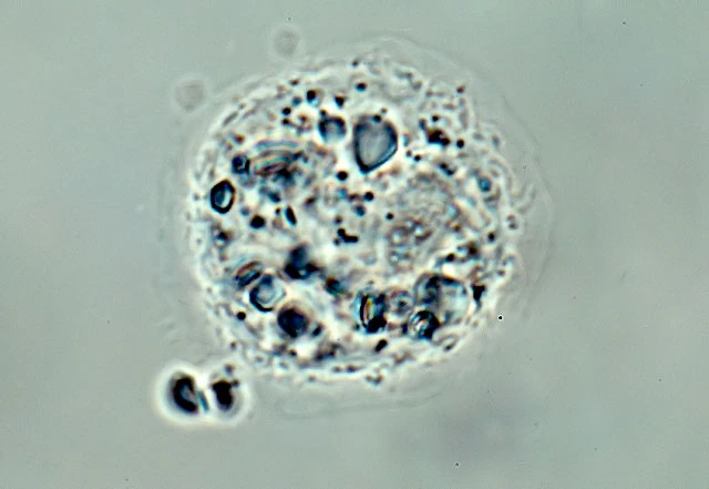 Cochliopodium barki