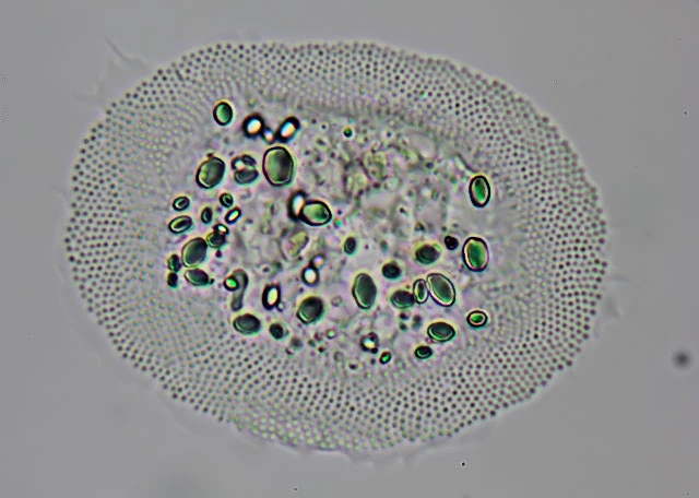 Cochliopodium bilimbosum