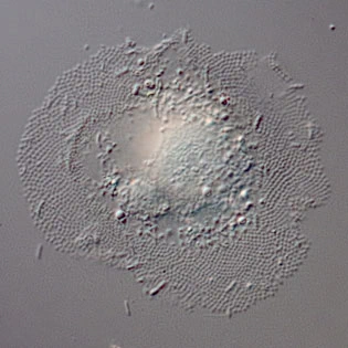 Cochliopodium