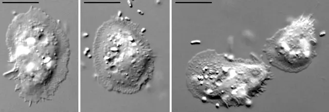 Cochliopodium