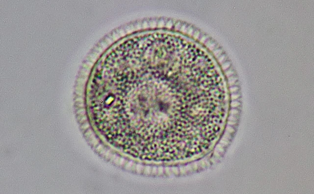 Cochliopodium spec.
