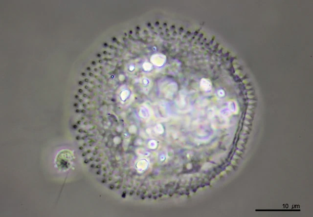 Cochliopodium spec.