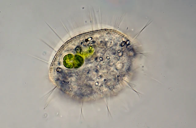Cochliopodium vestitum