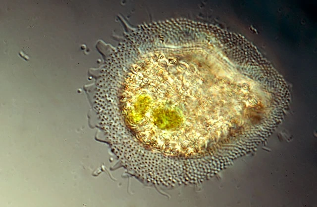 Cochliopodium vestitum