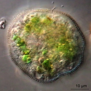 Cochliopodium vestitum