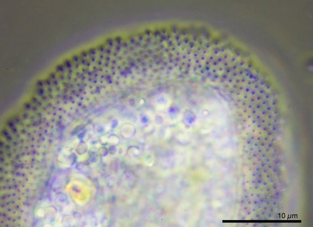 Cochliopodium vestitum