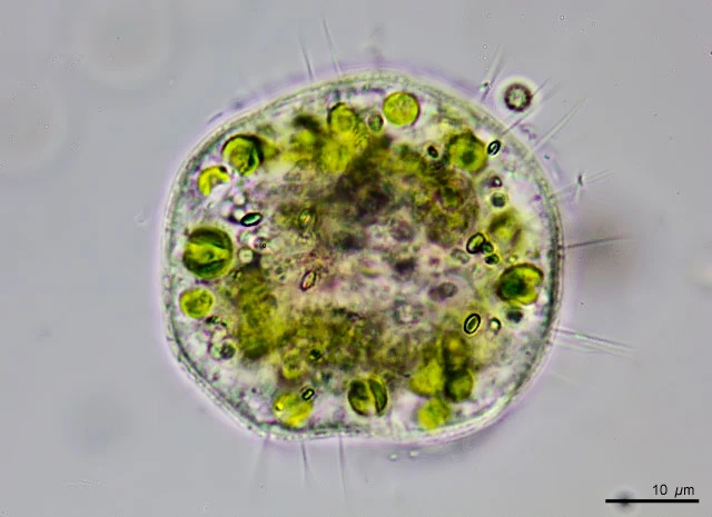 Cochliopodium cf vestitum