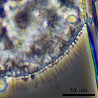 Cochliopodium vestitum