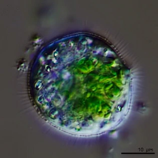 Cochliopodium vestitum