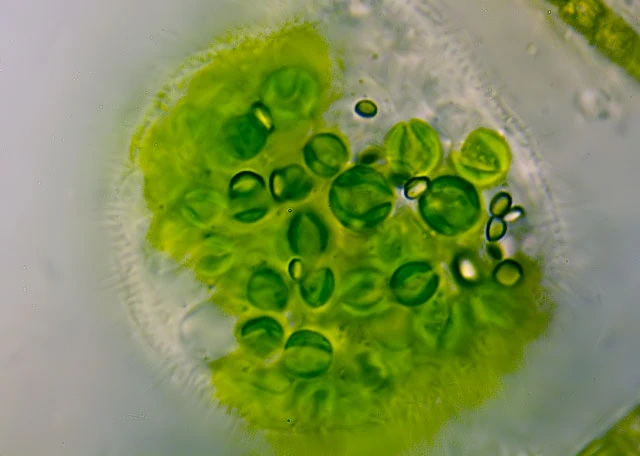 Cochliopodium vestitum