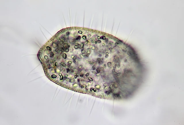 Cochliopodium vestitum
