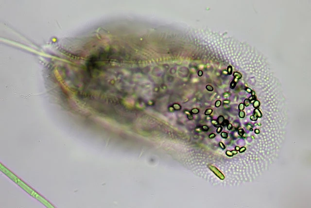 Cochliopodium vestitum