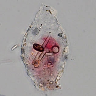 Difflugia mammillaris