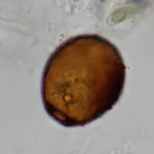 Cryptodifflugia oviformis