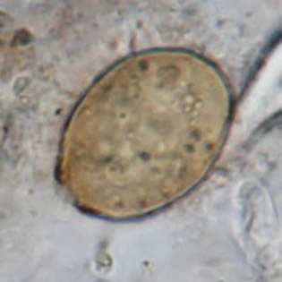 Cryptodifflugia oviformis