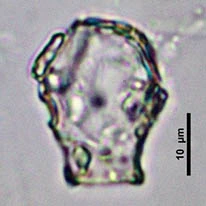 Cryptodifflugia sacculus