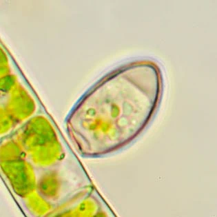 Cryptodifflugia compressa