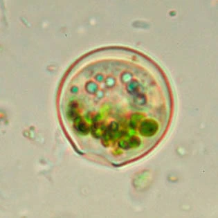 Cryptodifflugia compressa
