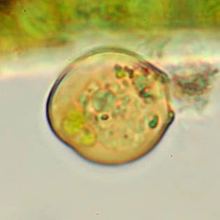 Cryptodifflugia compressa
