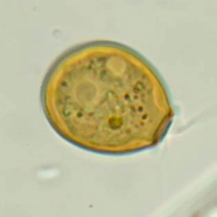 Cryptodifflugia compressa