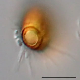 Cryptodifflugia compressa