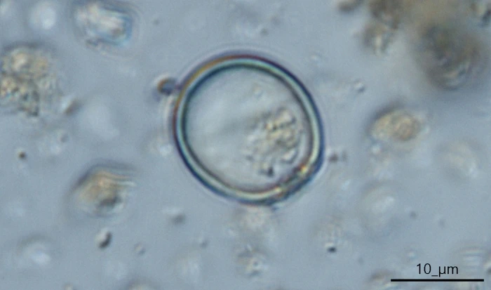Cryptodifflugia operculata