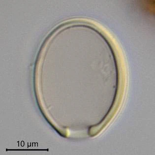Cryptodifflugia oviformis