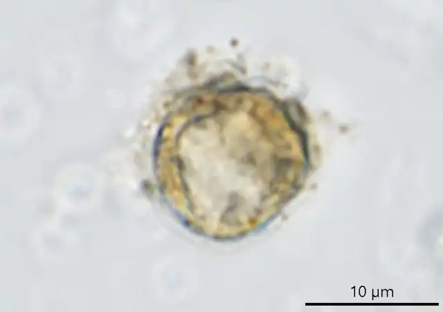 Cryptodifflugia patinata