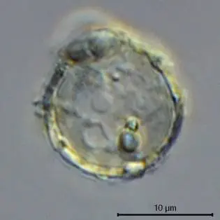 Cryptodifflugia patinata