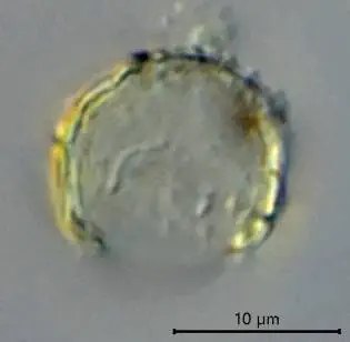 Cryptodifflugia patinata