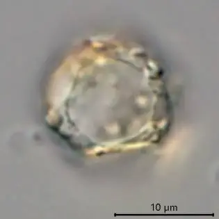 Cryptodifflugia patinata