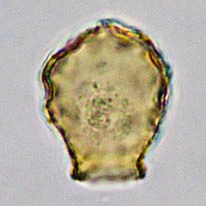 Cryptodifflugia sacculus