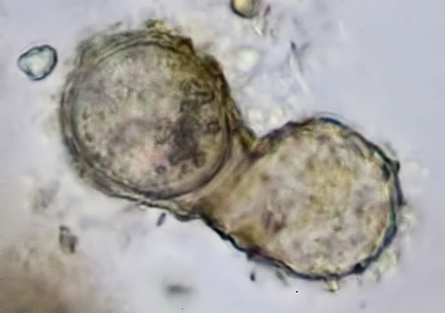Cryptodifflugia sacculus