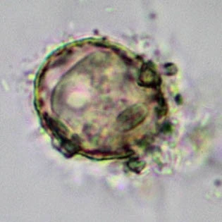 Phryganella paradoxa