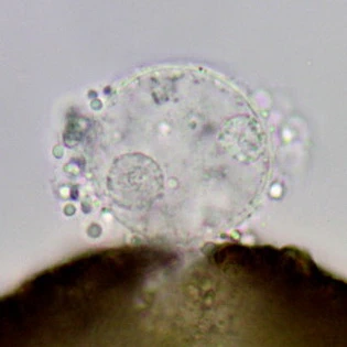 Cucurbitella vlasinensis
