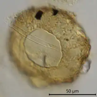 Cyclopyxis arcelloides