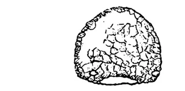 Cyclopyxis arcelloides gibbosa