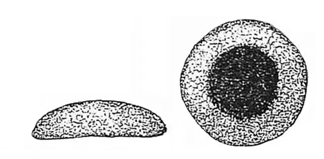 Cyclopyxis arenata
