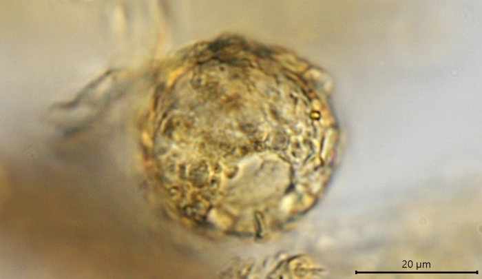 Cyclopyxis arcelloides gibbosa