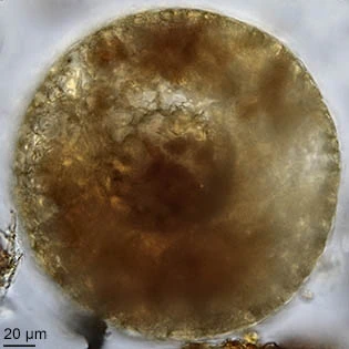 Cyclopyxis intermedia