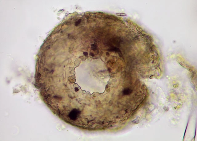 Cyclopyxis kahli