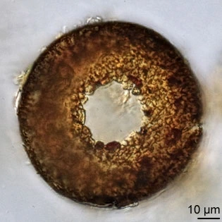 Cyclopyxis kahli