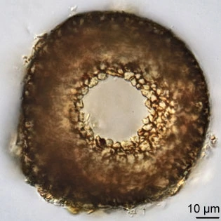 Cyclopyxis kahli