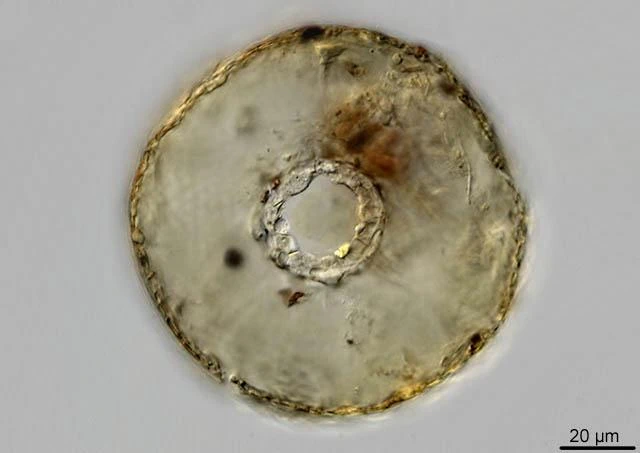 Cyclopyxis puteus
