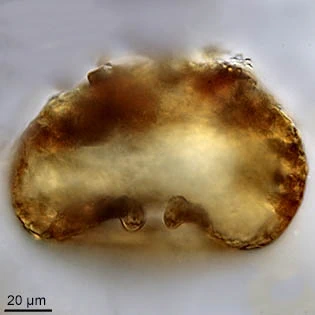 Cyclopyxis leidyi