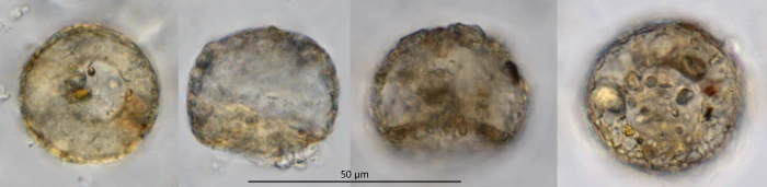 Cyclopyxis parvula