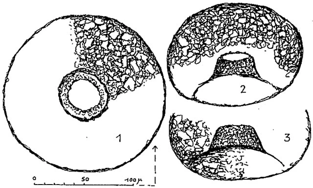 Cyclopyxis puteus