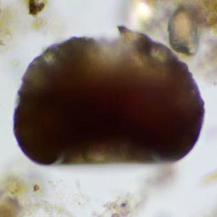 Cyclopyxis intermedia