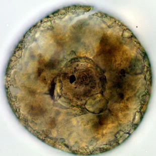 Cyclopyxis intermedia